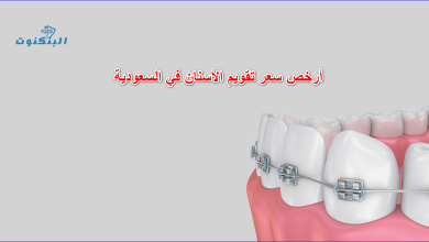 أرخص سعر تقويم الأسنان في السعودية